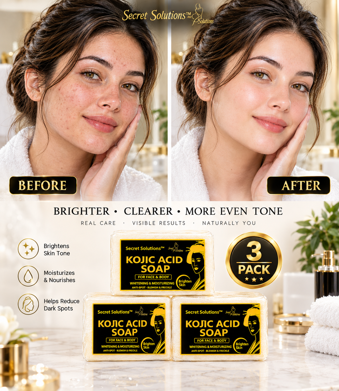 Before and after skin comparison of a woman with Secret Solutions Kojic Acid Soap, shown with three packaged soap bars and a 3-pack badge on a bright bathroom-style background.